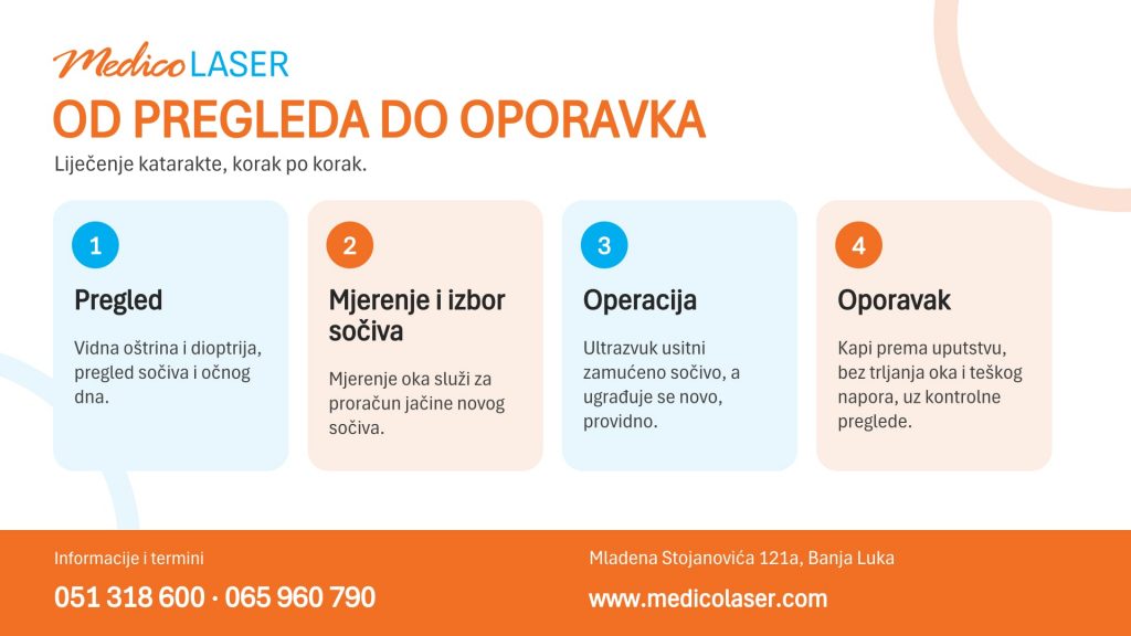 Medico-Laser-clanak-katarakta-3-infografika-koraci
